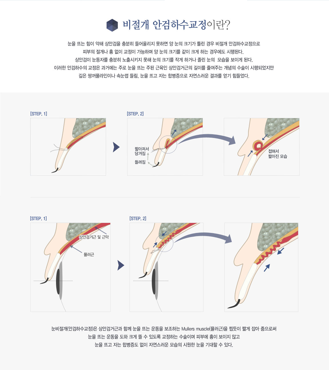 ���ű����̶�?