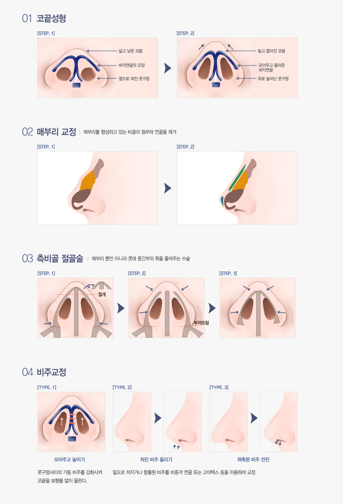 �ڳ����� �������