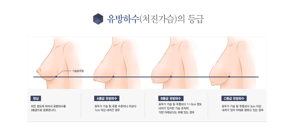 �����ϼ�(ó������)�� ���