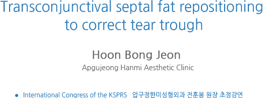 ��������ó���� ����