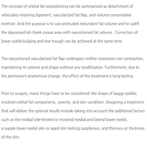 ��������ó���� ����