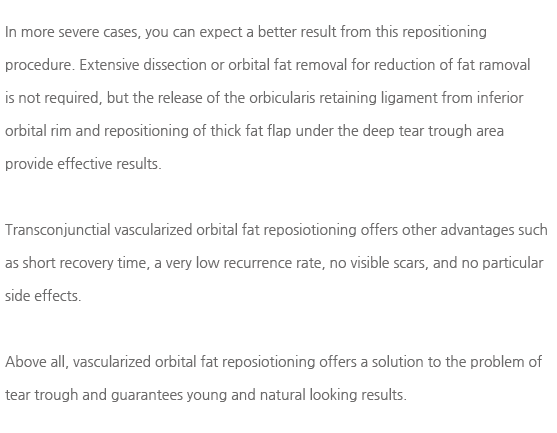 ��������ó���� ����